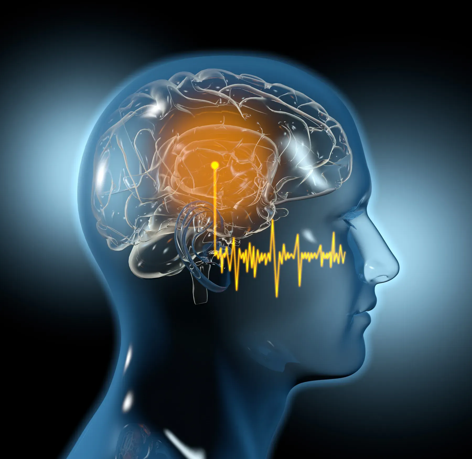 Tinnitus